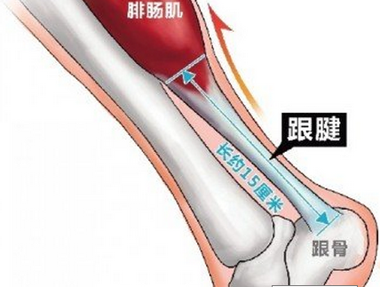 关于跟腱断裂术后并发症问题探究1